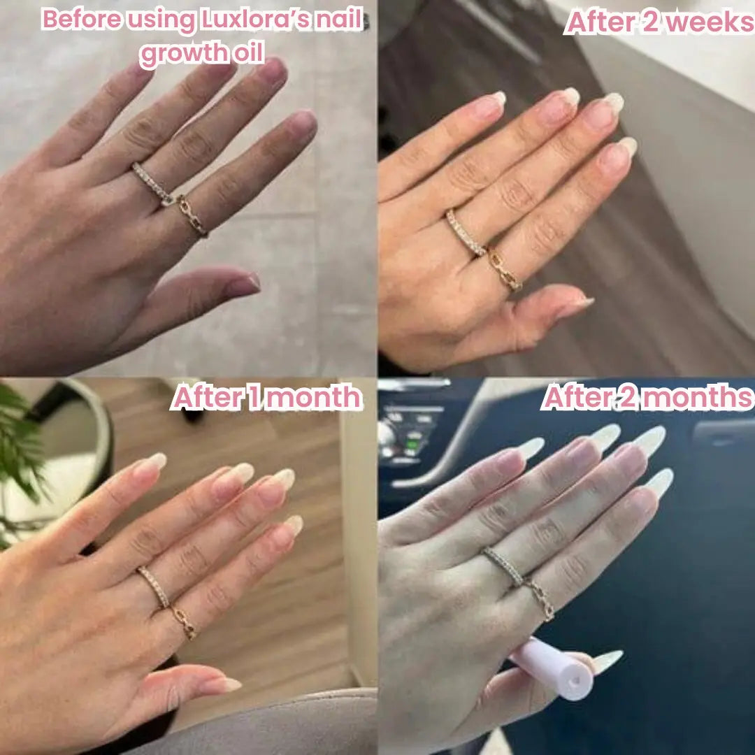 LUXLORA™ | Nails Growth Oil (Cuticle's oil)