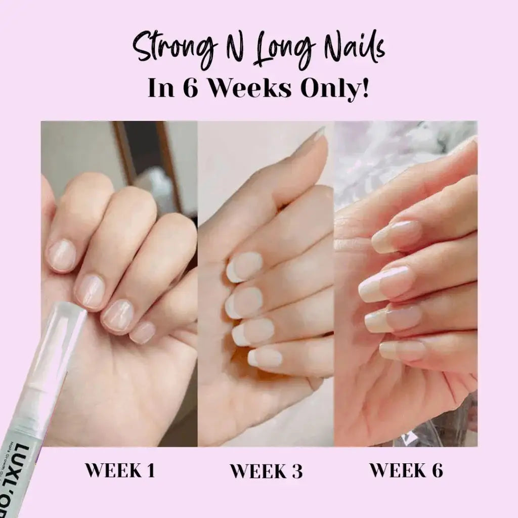 LUXLORA™ | Nails Growth Oil (Cuticle's oil)