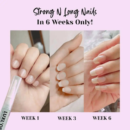 LUXLORA™ | Nails Growth Oil (Cuticle's oil)