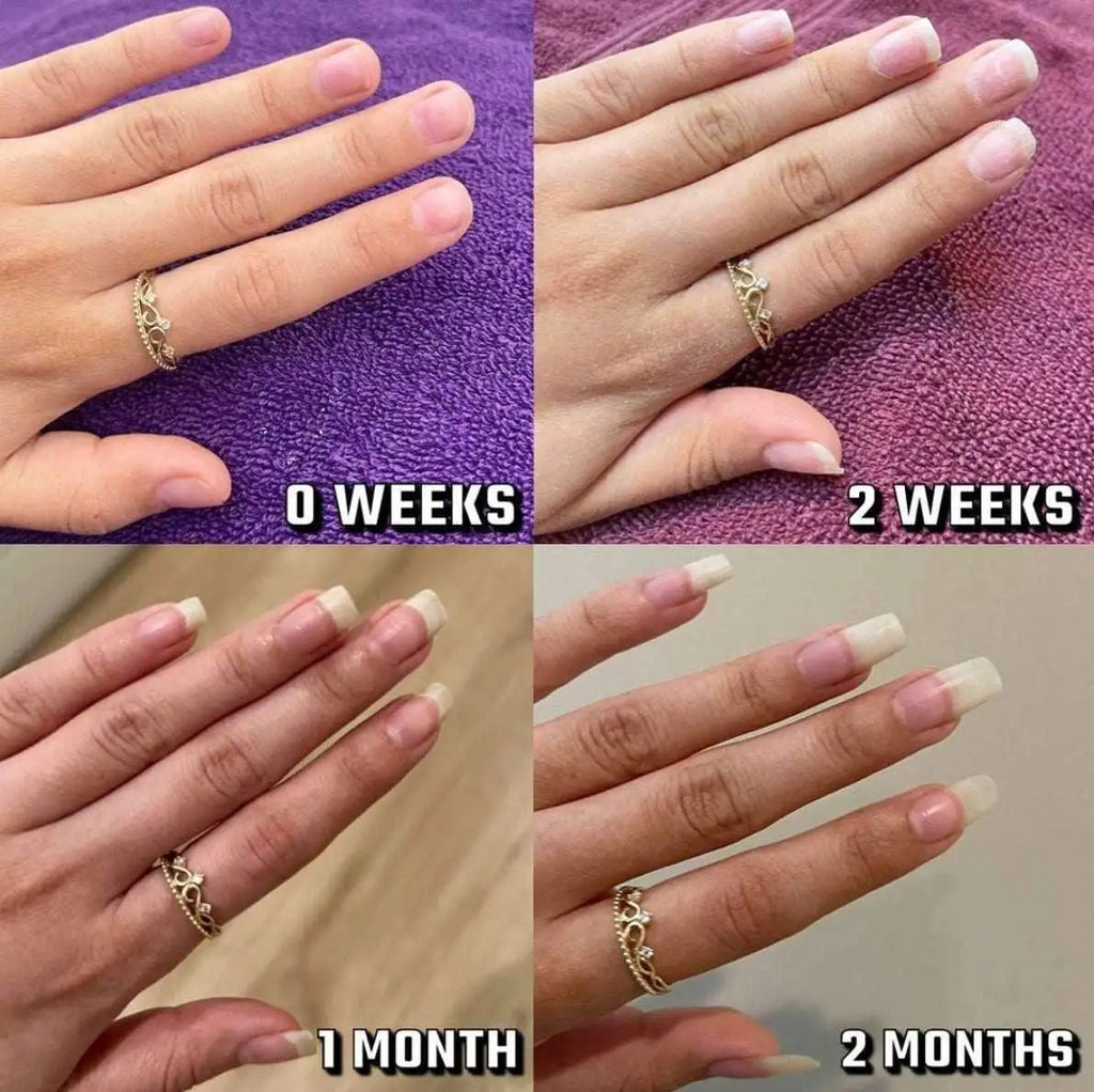 Nails Growth Oil | Cuticle Oil