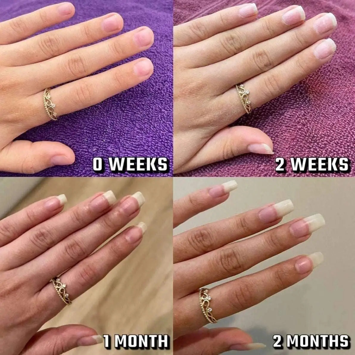 Nails Growth Oil | Cuticle Oil